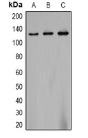 CACNA2D2 Antibody - Western blot analysis of CACNA2D2 expression in 293T (A); mouse brain (B); rat brain (C) whole cell lysates.