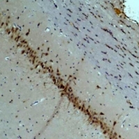 CACNA2D2 Antibody - Immunohistochemical analysis of CACNA2D2 staining in rat brain formalin fixed paraffin embedded tissue section. The section was pre-treated using heat mediated antigen retrieval with sodium citrate buffer (pH 6.0). The section was then incubated with the antibody at room temperature and detected using an HRP conjugated compact polymer system. DAB was used as the chromogen. The section was then counterstained with hematoxylin and mounted with DPX.