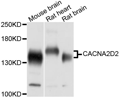 CACNA2D2 Antibody - Western blot analysis of extracts of various cell lines, using CACNA2D2 antibody at 1:1000 dilution. The secondary antibody used was an HRP Goat Anti-Rabbit IgG (H+L) at 1:10000 dilution. Lysates were loaded 25ug per lane and 3% nonfat dry milk in TBST was used for blocking. An ECL Kit was used for detection and the exposure time was 1s.