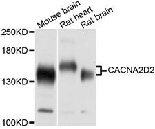 CACNA2D2 Antibody - Western blot analysis of extracts of various cell lines, using CACNA2D2 antibody at 1:1000 dilution. The secondary antibody used was an HRP Goat Anti-Rabbit IgG (H+L) at 1:10000 dilution. Lysates were loaded 25ug per lane and 3% nonfat dry milk in TBST was used for blocking. An ECL Kit was used for detection and the exposure time was 1s.