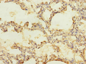 CACNA2D2 Antibody - Immunohistochemistry of paraffin-embedded human lung tissue at dilution 1:100