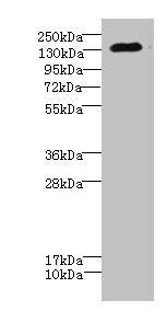 CACNA2D2 Antibody - Western blot All Lanes: CACNA2D2 antibody IgG at 4.51ug/ml+ Mouse brain tissue Secondary Goat polyclonal to rabbit IgG at 1/10000 dilution Predicted band size: 130,123,131 kDa Observed band size: 130 kDa