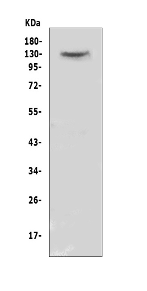 CACNA2D2 Antibody - Western blot analysis of CACNA2D2 using anti-CACNA2D2 antibody. Electrophoresis was performed on a 5-20% SDS-PAGE gel at 70V (Stacking gel) / 90V (Resolving gel) for 2-3 hours. The sample well of each lane was loaded with 50ug of sample under reducing conditions. Lane 1: human MCF-7 whole cell lysate. After Electrophoresis, proteins were transferred to a Nitrocellulose membrane at 150mA for 50-90 minutes. Blocked the membrane with 5% Non-fat Milk/ TBS for 1.5 hour at RT. The membrane was incubated with rabbit anti-CACNA2D2 antigen affinity purified polyclonal antibody at 0.5 µg/mL overnight at 4°C, then washed with TBS-0.1% Tween 3 times with 5 minutes each and probed with a goat anti-rabbit IgG-HRP secondary antibody at a dilution of 1:10000 for 1.5 hour at RT. The signal is developed using an Enhanced Chemiluminescent detection (ECL) kit with Tanon 5200 system. A specific band was detected for CACNA2D2 at approximately 130KD. The expected band size for CACNA2D2 is at 130KD.