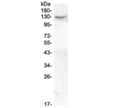 CACNA2D2 Antibody - Western blot testing of human MCF7 cell lysate with CACNA2D2 antibody at 0.5ug/ml. Predicted molecular weight ~130 kDa.