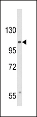 CACNA2D3 / Alpha-2/Delta-3 Antibody - Western blot of CACNA2D3 Antibody in HepG2 cell line lysates (35 ug/lane). CACNA2D3 (arrow) was detected using the purified antibody.
