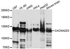 CACNA2D3 / Alpha-2/Delta-3 Antibody - Western blot analysis of extract of various cells.