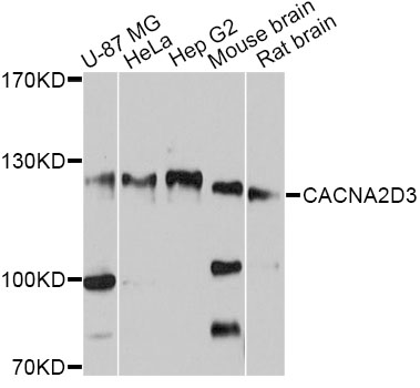 CACNA2D3 / Alpha-2/Delta-3 Antibody - Western blot analysis of extracts of various cell lines, using CACNA2D3 antibody at 1:3000 dilution. The secondary antibody used was an HRP Goat Anti-Rabbit IgG (H+L) at 1:10000 dilution. Lysates were loaded 25ug per lane and 3% nonfat dry milk in TBST was used for blocking. An ECL Kit was used for detection and the exposure time was 10s.
