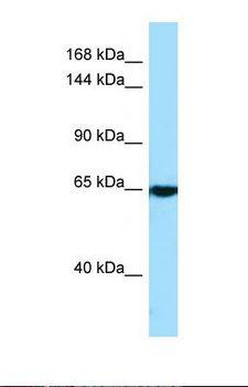 CACNA2D4 Antibody - Western blot of Human A549. CACNA2D4 antibody dilution 1.0 ug/ml.  This image was taken for the unconjugated form of this product. Other forms have not been tested.