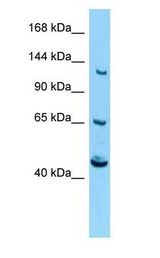 CACNA2D4 Antibody - CACNA2D4 antibody Western Blot of Mouse Pancreas.  This image was taken for the unconjugated form of this product. Other forms have not been tested.