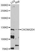 CACNA2D4 Antibody - Western blot analysis of extracts of various cell lines, using CACNA2D4 antibody at 1:1000 dilution. The secondary antibody used was an HRP Goat Anti-Rabbit IgG (H+L) at 1:10000 dilution. Lysates were loaded 25ug per lane and 3% nonfat dry milk in TBST was used for blocking. An ECL Kit was used for detection and the exposure time was 90s.