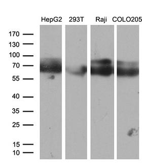 CACNB1 Antibody - Western blot analysis of extracts. (35ug) from 4 different cell lines by using anti-CACNB1 monoclonal antibody. (1:500)