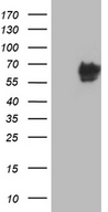 CACNB1 Antibody - HEK293T cells were transfected with the pCMV6-ENTRY control. (Left lane) or pCMV6-ENTRY CACNB1. (Right lane) cDNA for 48 hrs and lysed