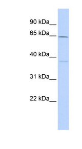 CACNB1 Antibody - CACNB1 antibody Western blot of Fetal Brain lysate. This image was taken for the unconjugated form of this product. Other forms have not been tested.