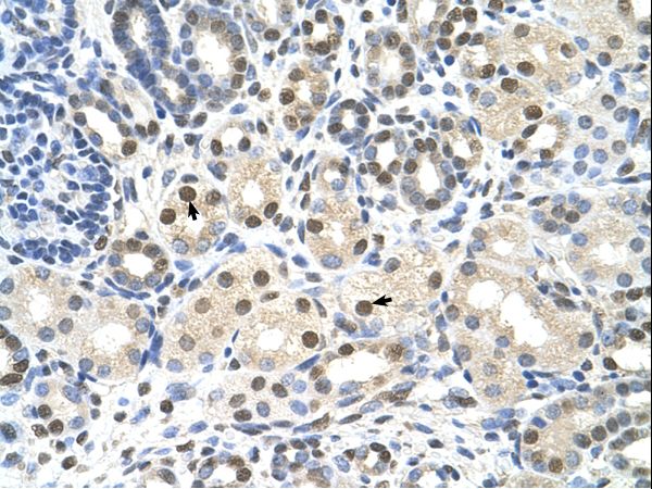 CACNB1 Antibody - CACNB1 antibody ARP35579_P050-NP_954855-CACNB1(calcium channel, voltage-dependent, beta 1 subunit) Antibody was used in IHC to stain formalin-fixed, paraffin-embedded human kidney.  This image was taken for the unconjugated form of this product. Other forms have not been tested.
