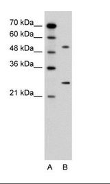 CACNB1 Antibody - A: Marker, B: Jurkat Cell Lysate.  This image was taken for the unconjugated form of this product. Other forms have not been tested.