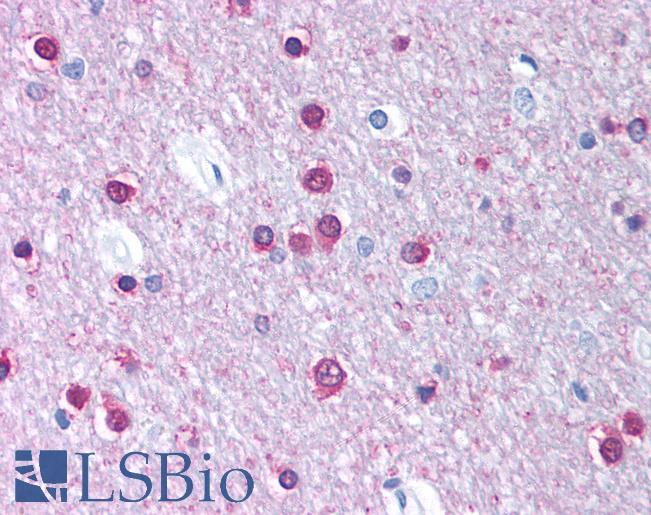 CACNB1 Antibody - Anti-CACNB1 antibody IHC of human brain, cortex, white matter. Immunohistochemistry of formalin-fixed, paraffin-embedded tissue after heat-induced antigen retrieval. Antibody concentration 5 ug/ml.  This image was taken for the unconjugated form of this product. Other forms have not been tested.