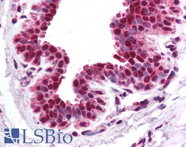CACNB1 Antibody - Anti-CACNB1 antibody IHC of human breast. Immunohistochemistry of formalin-fixed, paraffin-embedded tissue after heat-induced antigen retrieval. Antibody concentration 5 ug/ml.  This image was taken for the unconjugated form of this product. Other forms have not been tested.
