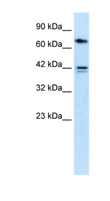 CACNB1 Antibody - CACNB1 antibody Western blot of HepG2 cell lysate. This image was taken for the unconjugated form of this product. Other forms have not been tested.