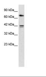 CACNB1 Antibody - HepG2 Cell Lysate.  This image was taken for the unconjugated form of this product. Other forms have not been tested.