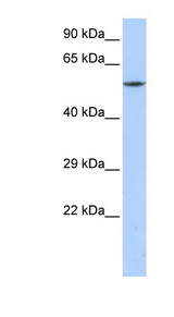 CACNB1 Antibody - CACNB1 antibody Western blot of MCF7 cell lysate. This image was taken for the unconjugated form of this product. Other forms have not been tested.