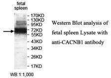 CACNB1 Antibody