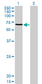 CACNB1 Antibody - Western Blot analysis of CACNB1 expression in transfected 293T cell line by CACNB1 monoclonal antibody (M01), clone 1G6.Lane 1: CACNB1 transfected lysate(65.7 KDa).Lane 2: Non-transfected lysate.