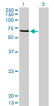 CACNB1 Antibody - Western Blot analysis of CACNB1 expression in transfected 293T cell line by CACNB1 monoclonal antibody (M01), clone 1G6.Lane 1: CACNB1 transfected lysate(65.7 KDa).Lane 2: Non-transfected lysate.