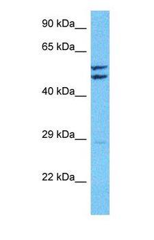 CACNB1 Antibody - Western blot of CACNB1 Antibody with human Jurkat Whole Cell lysate.  This image was taken for the unconjugated form of this product. Other forms have not been tested.