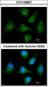 CACNB1 Antibody - Immunofluorescence of methanol-fixed HeLa, using CACNB1 antibody at 1:200 dilution.