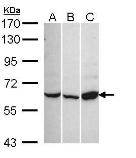 CACNB1 Antibody - Sample (30 ug of whole cell lysate). A: 293T. B: Hep G2. C: Raji. 7.5% SDS PAGE. CACNB1 antibody diluted at 1:1000. 
