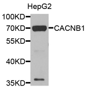 CACNB1 Antibody - Western blot analysis of extracts of HepG2 cells.