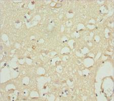 CACNB1 Antibody - Immunohistochemistry of paraffin-embedded human brain tissue at dilution 1:100