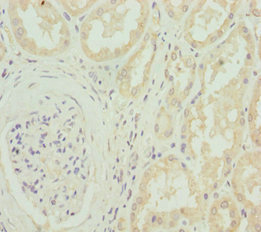 CACNB1 Antibody - Immunohistochemistry of paraffin-embedded human kidney tissue at dilution 1:100