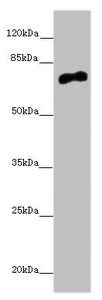CACNB1 Antibody - Western blot All Lanes:CACNB1 antibody at 6.68 ug/ml + HepG-2 whole cell lysate Secondary Goat polyclonal to rabbit IgG at 1/10000 dilution Predicted band size: 66,58,54 kDa Observed band size: 66 kDa