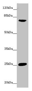 CACNB1 Antibody - Western blot All Lanes:CACNB1 antibody at 8.2 ug/ml + Mouse liver tissue Secondary Goat polyclonal to rabbit IgG at 1/10000 dilution Predicted band size: 66,58,54 kDa Observed band size: 66 kDa