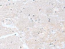 CACNB1 Antibody - Immunohistochemistry of paraffin-embedded Human brain tissue  using CACNB1 Polyclonal Antibody at dilution of 1:100(×200)