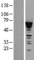 CACNB1 Protein - Western validation with an anti-DDK antibody * L: Control HEK293 lysate R: Over-expression lysate