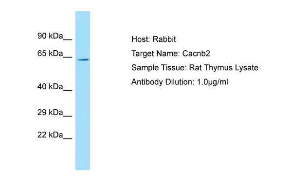 CACNB2 Antibody -  This image was taken for the unconjugated form of this product. Other forms have not been tested.