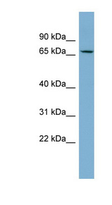 CACNB2 Antibody - CACNB2 antibody Western blot of Fetal Thymus lysate. This image was taken for the unconjugated form of this product. Other forms have not been tested.