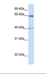 CACNB2 Antibody - Fetal heart lysate. Antibody concentration: 1.0 ug/ml. Gel concentration: 12%.  This image was taken for the unconjugated form of this product. Other forms have not been tested.