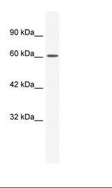 CACNB2 Antibody - Raji Cell Lysate.  This image was taken for the unconjugated form of this product. Other forms have not been tested.