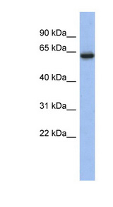 CACNB2 Antibody - CACNB2 antibody Western blot of Fetal Kidney lysate. This image was taken for the unconjugated form of this product. Other forms have not been tested.