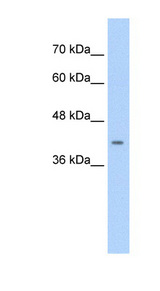 CACNB2 Antibody - CACNB2 antibody ARP35598_T100-EAW86193-CACNB2(calcium channel, voltage-dependent, beta 2 subunit) Antibody Western blot of Jurkat lysate.  This image was taken for the unconjugated form of this product. Other forms have not been tested.