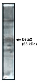 CACNB2 Antibody - Western blot of beta2 antibody on rat brain lysate.