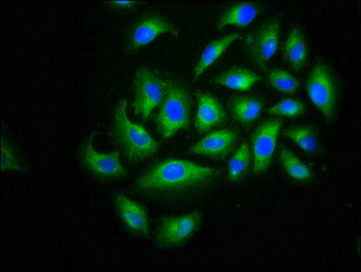 CACNB2 Antibody - Immunofluorescence staining of A549 cells at a dilution of 1:166, counter-stained with DAPI. The cells were fixed in 4% formaldehyde, permeabilized using 0.2% Triton X-100 and blocked in 10% normal Goat Serum. The cells were then incubated with the antibody overnight at 4 °C.The secondary antibody was Alexa Fluor 488-congugated AffiniPure Goat Anti-Rabbit IgG (H+L) .