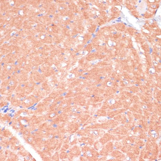 CACNB2 Antibody - Immunohistochemistry of paraffin-embedded Mouse heart using CACNB2 Polyclonal Antibody at dilution of 1:100 (40x lens).