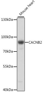 CACNB2 Antibody - Western blot analysis of extracts of mouse heart using CACNB2 Polyclonal Antibody at dilution of 1:1000.
