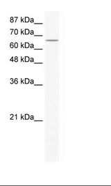 CACNB2 Antibody - HepG2 Cell Lysate.  This image was taken for the unconjugated form of this product. Other forms have not been tested.