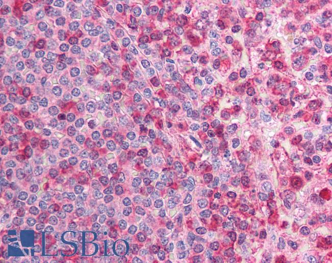 CACNB2 Antibody - Anti-CACNB2 antibody IHC of human spleen. Immunohistochemistry of formalin-fixed, paraffin-embedded tissue after heat-induced antigen retrieval. Antibody concentration 5 ug/ml.  This image was taken for the unconjugated form of this product. Other forms have not been tested.