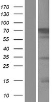 CACNB2 Protein - Western validation with an anti-DDK antibody * L: Control HEK293 lysate R: Over-expression lysate